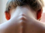 Abbott spinal cord stimulator lawsuit Abbott spinal cord stimulator lawsuit