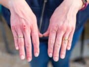 5 Key Factors in Personal Injury Settlement Value