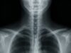 When Life-Threatening Conditions Are Missed on Routine X-Rays