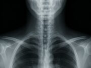 When Life-Threatening Conditions Are Missed on Routine X-Rays Home