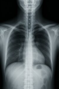 When Life-Threatening Conditions Are Missed on Routine X-Rays