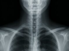 When Life-Threatening Conditions Are Missed on Routine X-Rays
