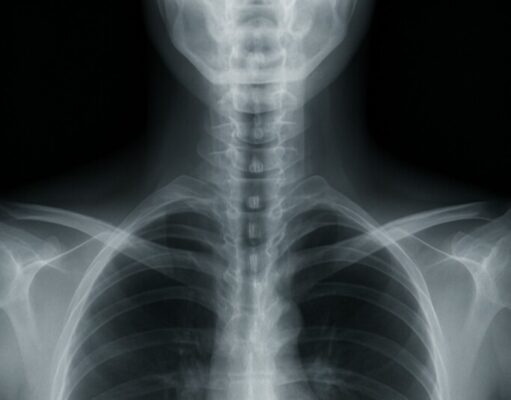 When Life-Threatening Conditions Are Missed on Routine X-Rays